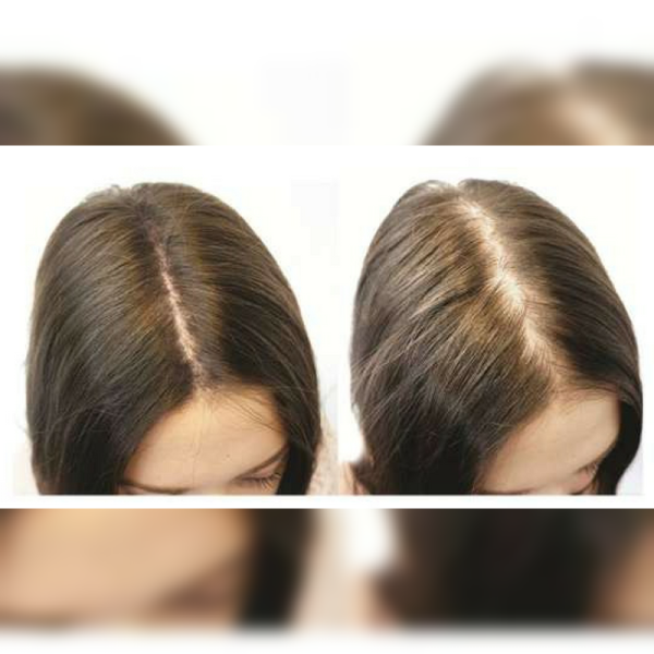 REJUVILLE Hair Tonic 60ml - Image 3