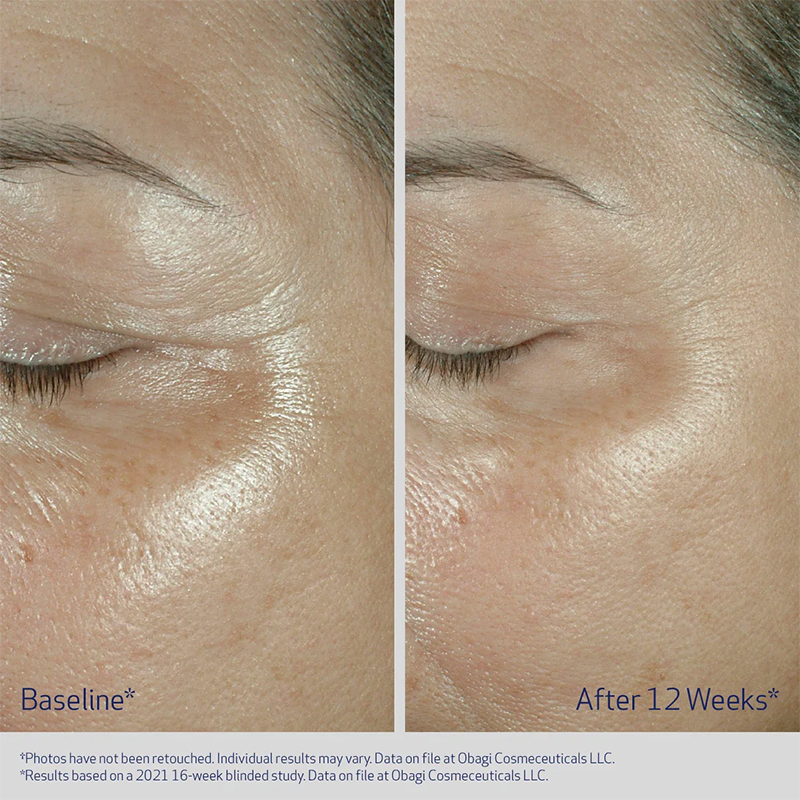 ELASTIderm Eye Serum 0.47 fl oz (14 mL) - Image 2