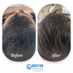 Cleopatra Hair Revive