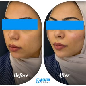 Cleopatra Lift Makeover