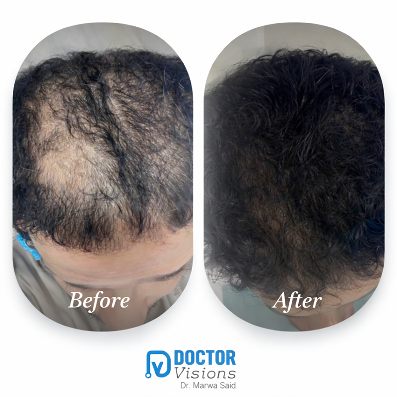 Cleopatra Hair Revive - Image 2